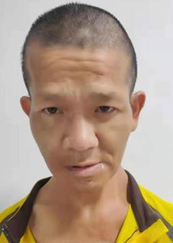 走失者照片 帮他回家：汕头青年男子被救助数月，...