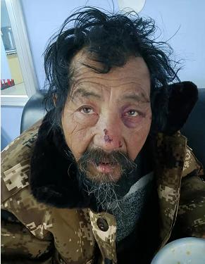 走失者照片 松原寻亲：六旬老人被救助，自述叫齐...