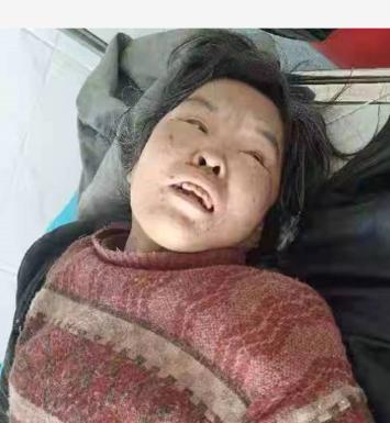 走失者照片 鞍山寻亲：海城五旬女子被救助，穿红...