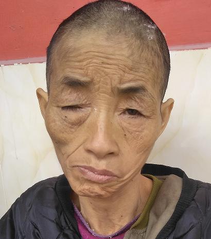 走失者照片 玉林寻亲：六旬老太被救助，穿黑色外...