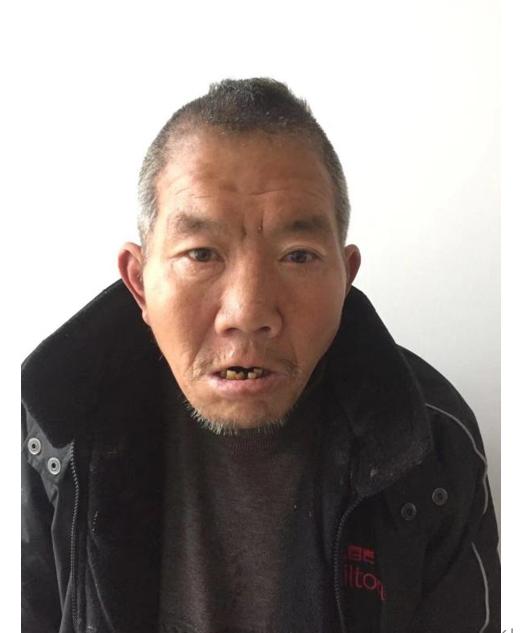走失者照片 滁州寻亲：六旬老人被救助，自述叫周...