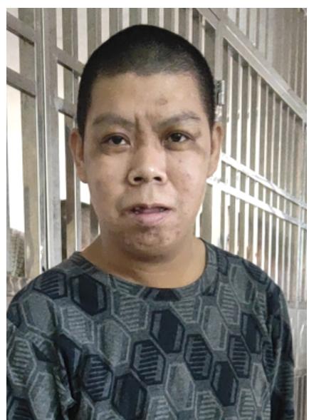 走失者照片 汕头寻亲：中年男子被救助，高约1米...