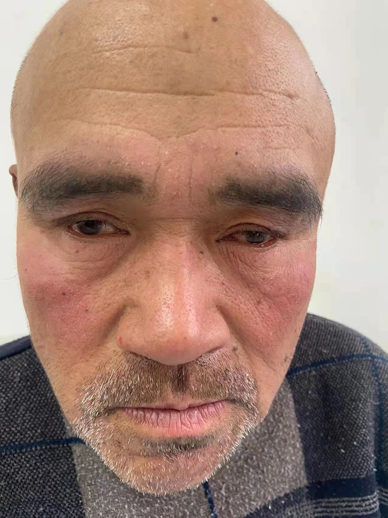 走失者照片 南通如皋市寻亲：七旬老人被救助，自...