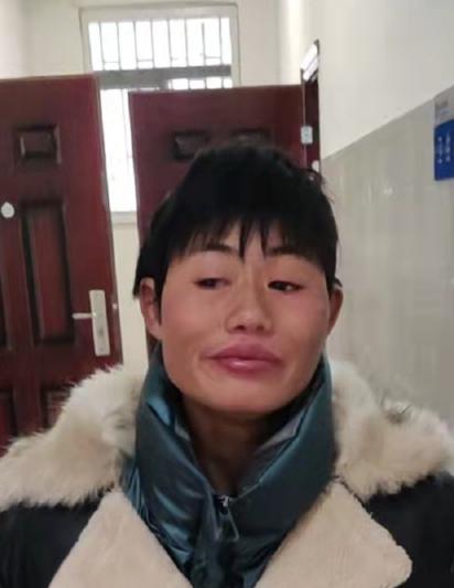 走失者照片 徐州寻亲：中年女子被救助，短发，穿...