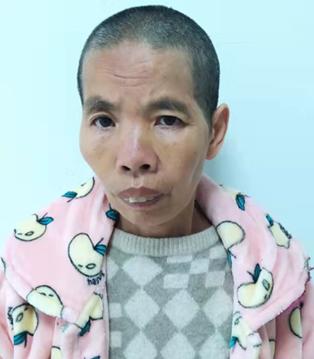 走失者照片 汕头寻亲：五旬女子被救助多日，衣衫...