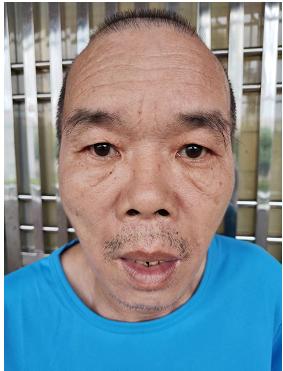 走失者照片 广州寻亲：六旬老人被救助，自述叫黄...