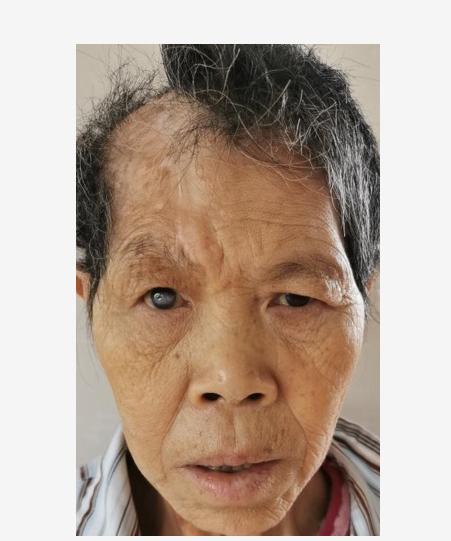 走失者照片 寻亲：中年女子在佛山被救助数月，疑...