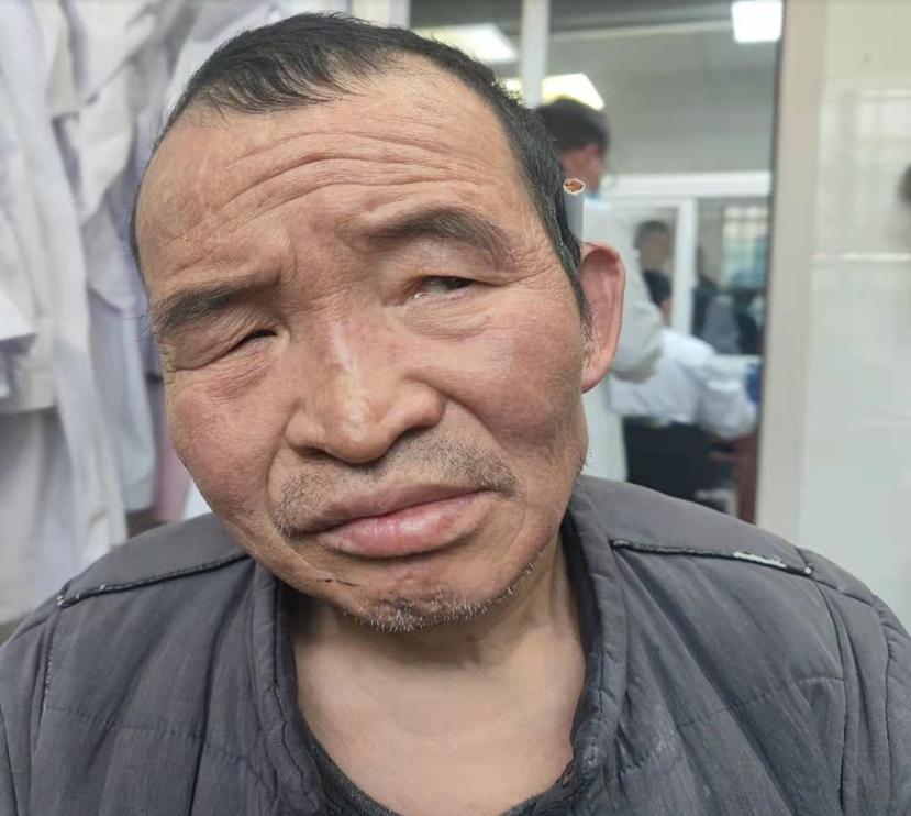 走失者照片 毕节寻亲：七旬老人被救助，自述叫小...