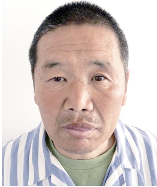 走失者照片 寻亲：五旬男子在北京被救助多年，高...
