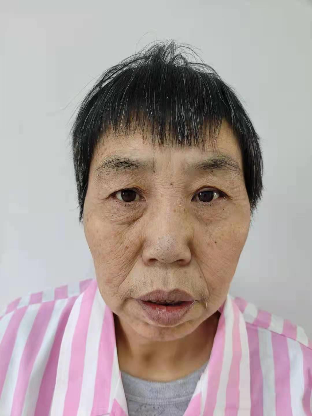 走失者照片 帮她回家：北京五旬女子被救助多年，...
