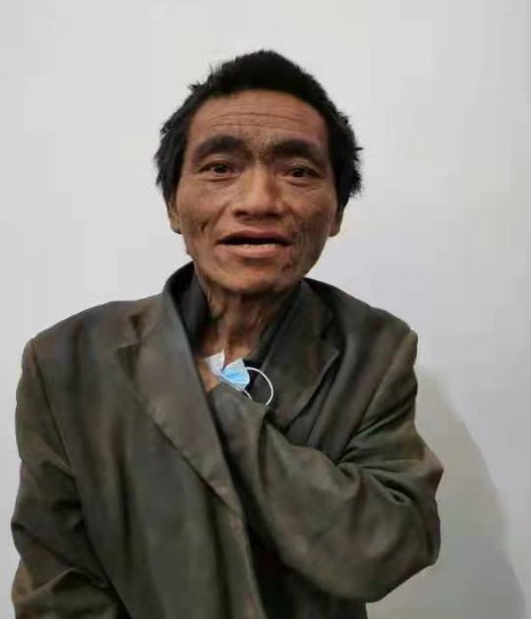 走失者照片 抚州寻亲：五旬男子被救助，疑患精神...