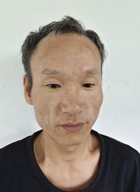 走失者照片 南宁寻亲：中年男子被救助，自述叫江...