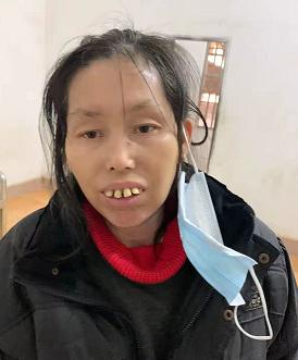 走失者照片 梧州寻亲：中年女子被救助，疑似精神...