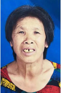 走失者照片 徐州急寻：七旬老太走失，戴紫色帽子...