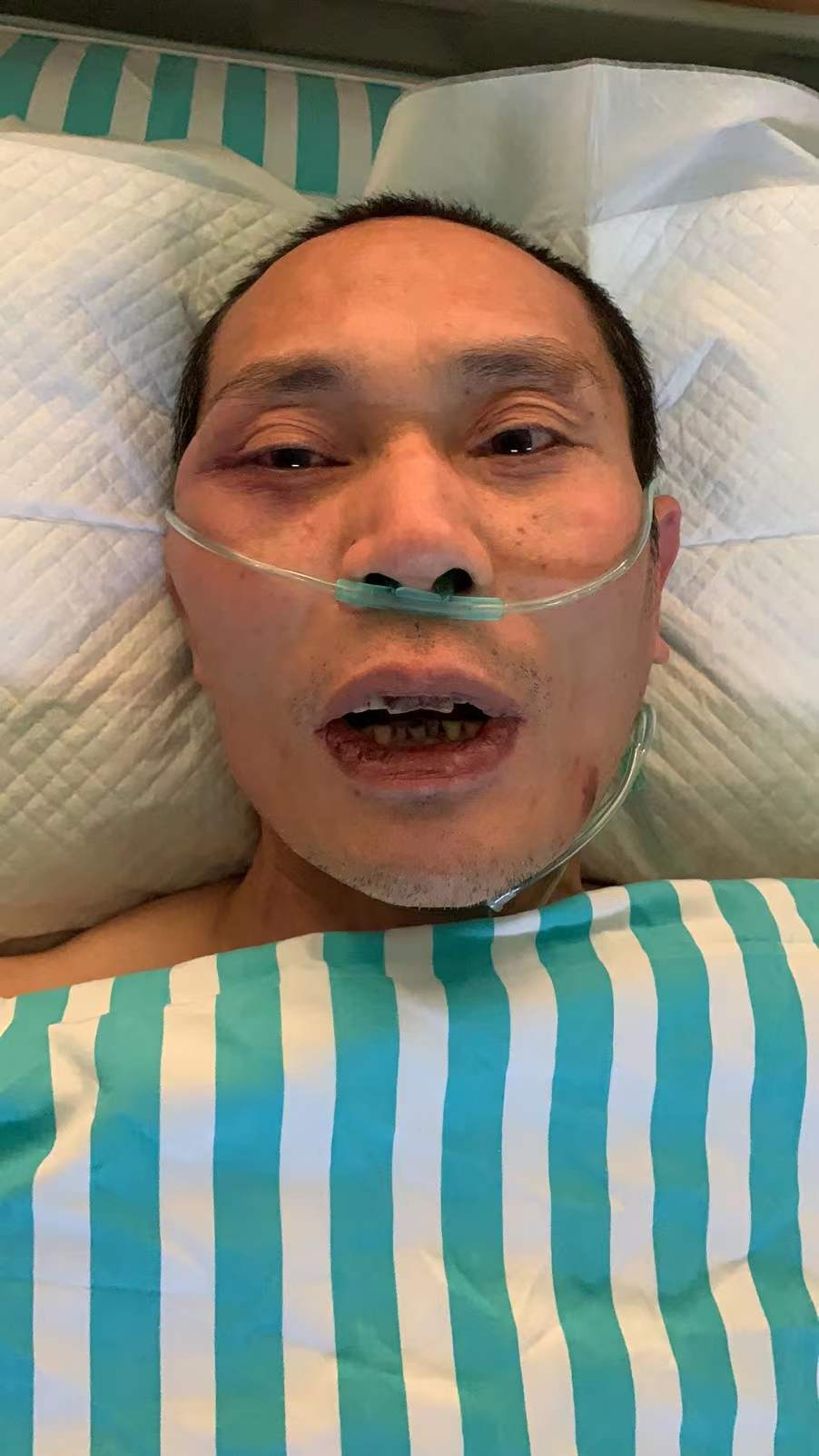 走失者照片 患者寻亲：五旬男子在唐山被送医，名...