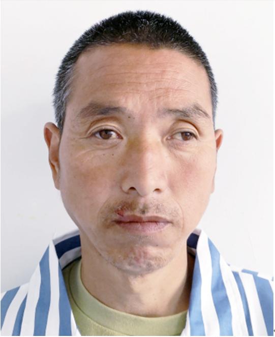 走失者照片 北京寻亲：青年男子被救助多年，高1...