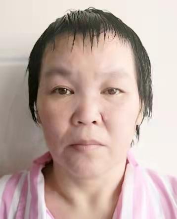 走失者照片 急寻亲友：北京五旬女子被救助，右手...