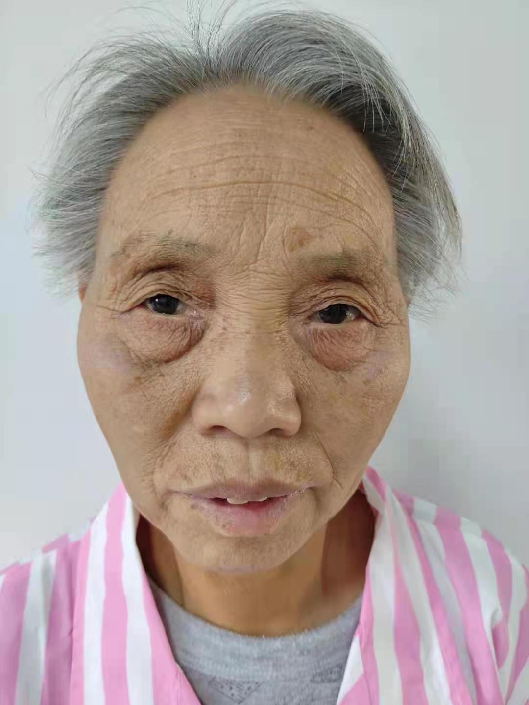 走失者照片 北京寻亲：六旬老太被救助多年，精神...