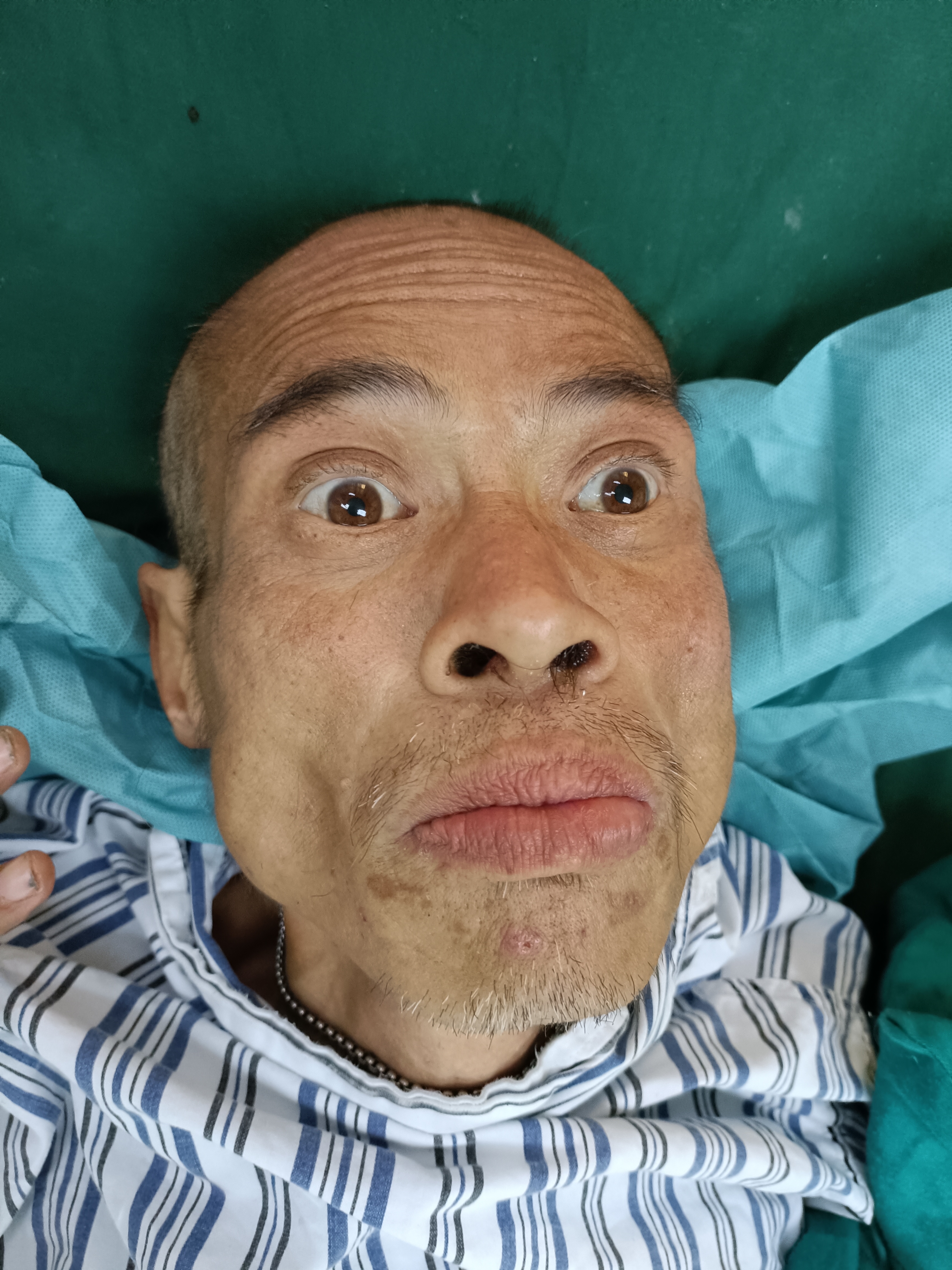 走失者照片 梧州寻亲：五旬男子被救助，被发现时...