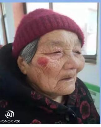 走失者照片 周口市八旬老太走失，患阿尔茨海默病...