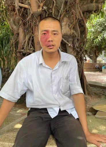 走失者照片 深圳寻亲：青年男子被救助，系流浪人...