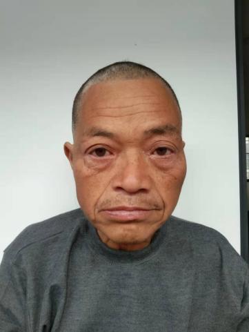 走失者照片 郴州寻亲：五旬男子被救助，自述叫梁...