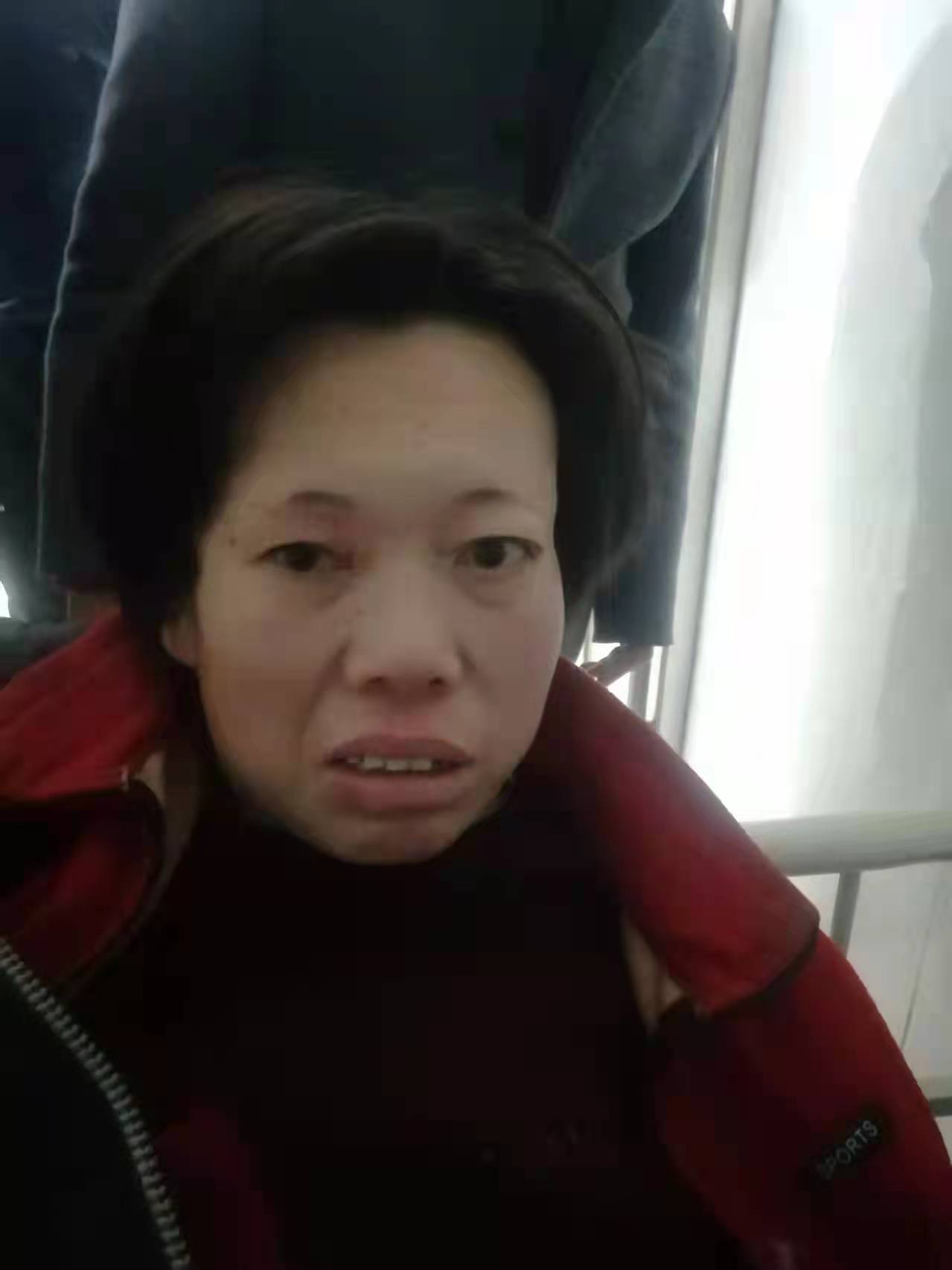 走失者照片 石家庄寻亲：中年女子被救助，不说话...