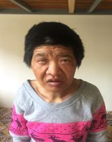 走失者照片 济宁寻亲：五旬女子被救助，高1米6...