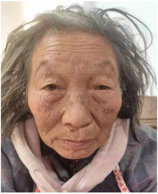 走失者照片 福州福清寻亲：七旬老太被救助，穿灰...