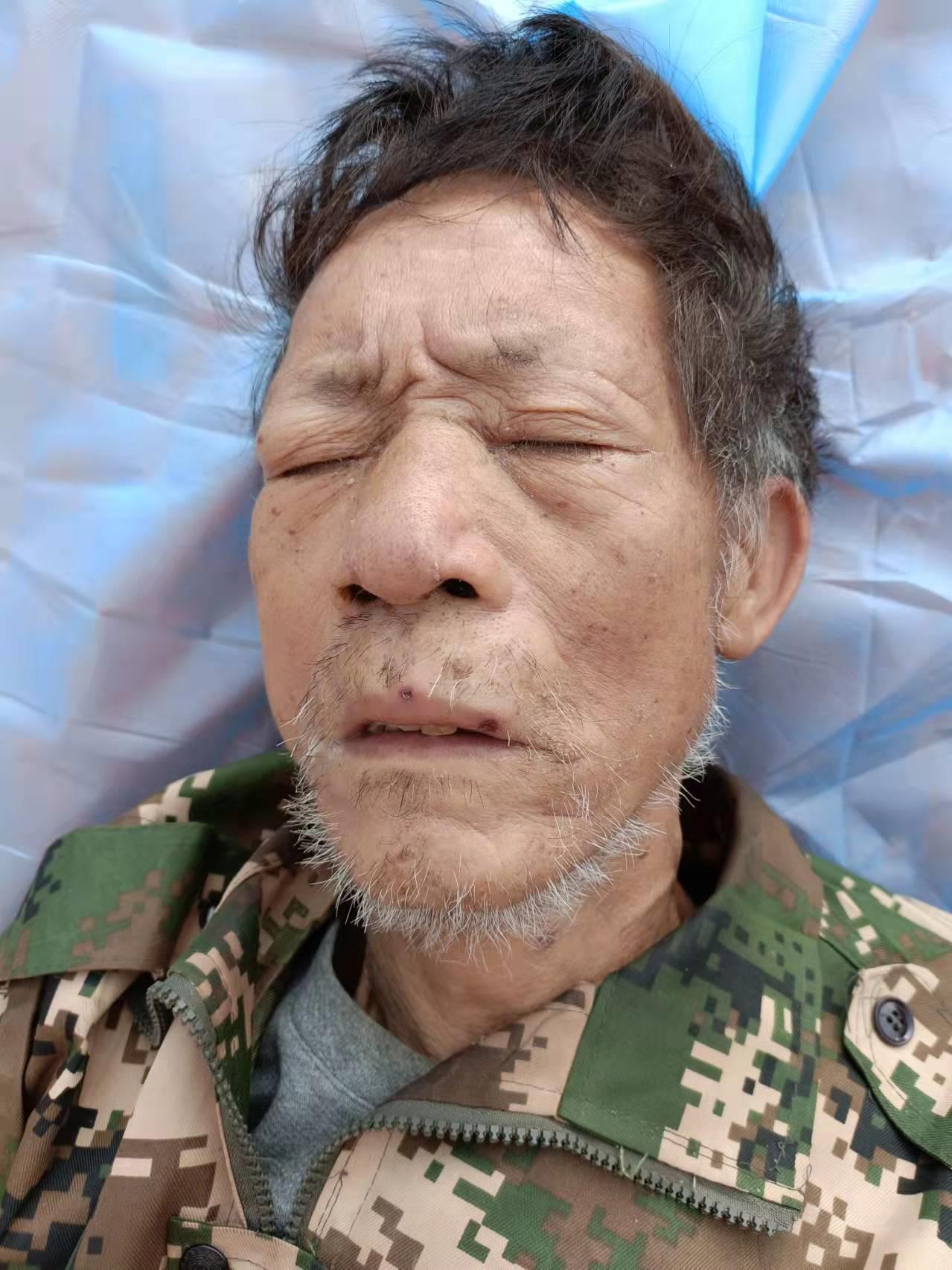 走失者照片 海南寻亲：定安县六旬老人被救助，身...
