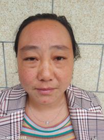 走失者照片 昭通寻亲:中年女子被救助多年,自述...