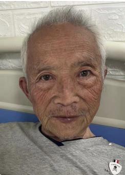 走失者照片 昆明寻亲：七旬老人被救助，自述叫高...