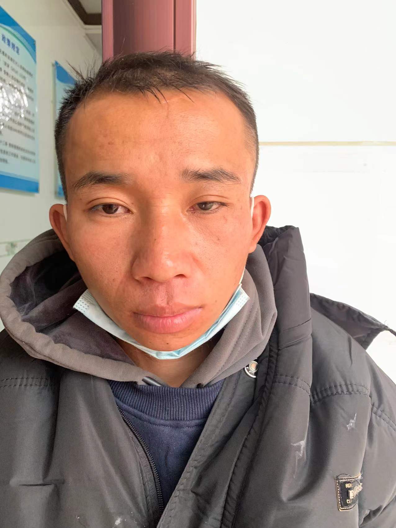 走失者照片 南宁寻亲：青年男子被救助，额头与后...