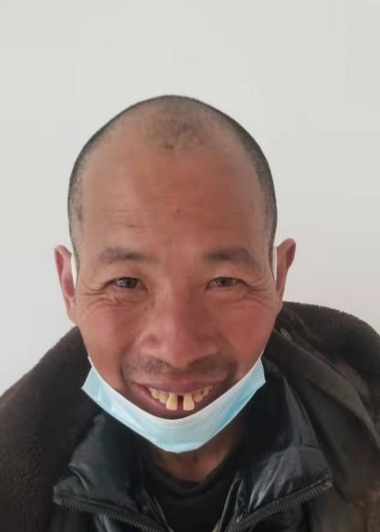 走失者照片 帮他回家：贵阳五旬男子被救助，兔牙...