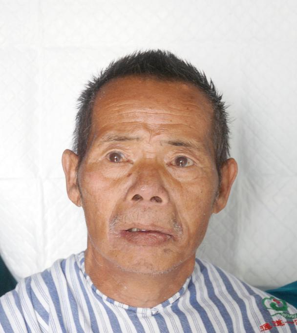 走失者照片 怀化寻亲：五旬男子被救助，穿黑色上...