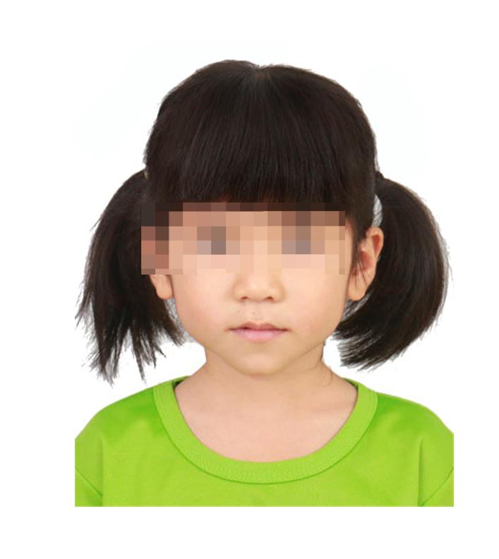走失者照片 海南东方寻亲：6岁女童被救助多年，...