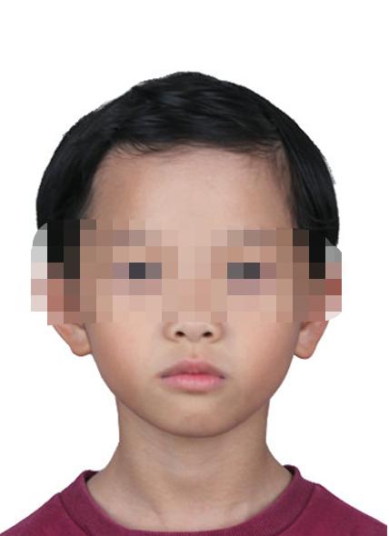 走失者照片 海南东方寻亲：7岁女孩自幼被救助，...