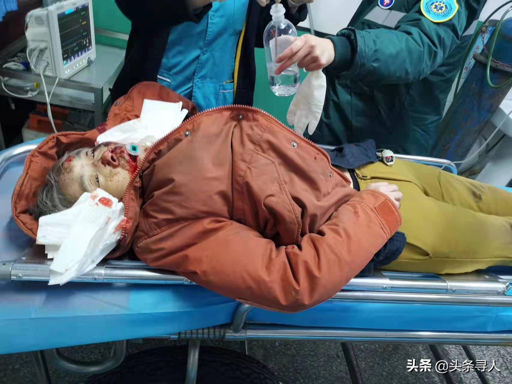 走失者照片 无名患者寻亲：洛阳五旬女子遭遇车祸...