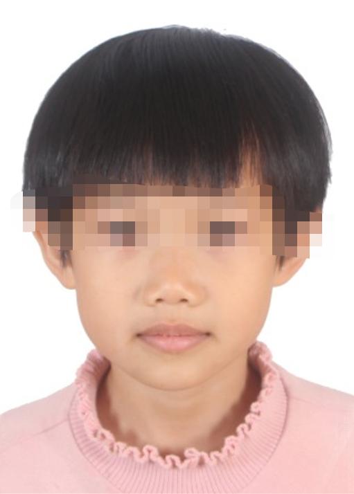 走失者照片 寻找亲人：海南东方市6岁女孩自幼被...