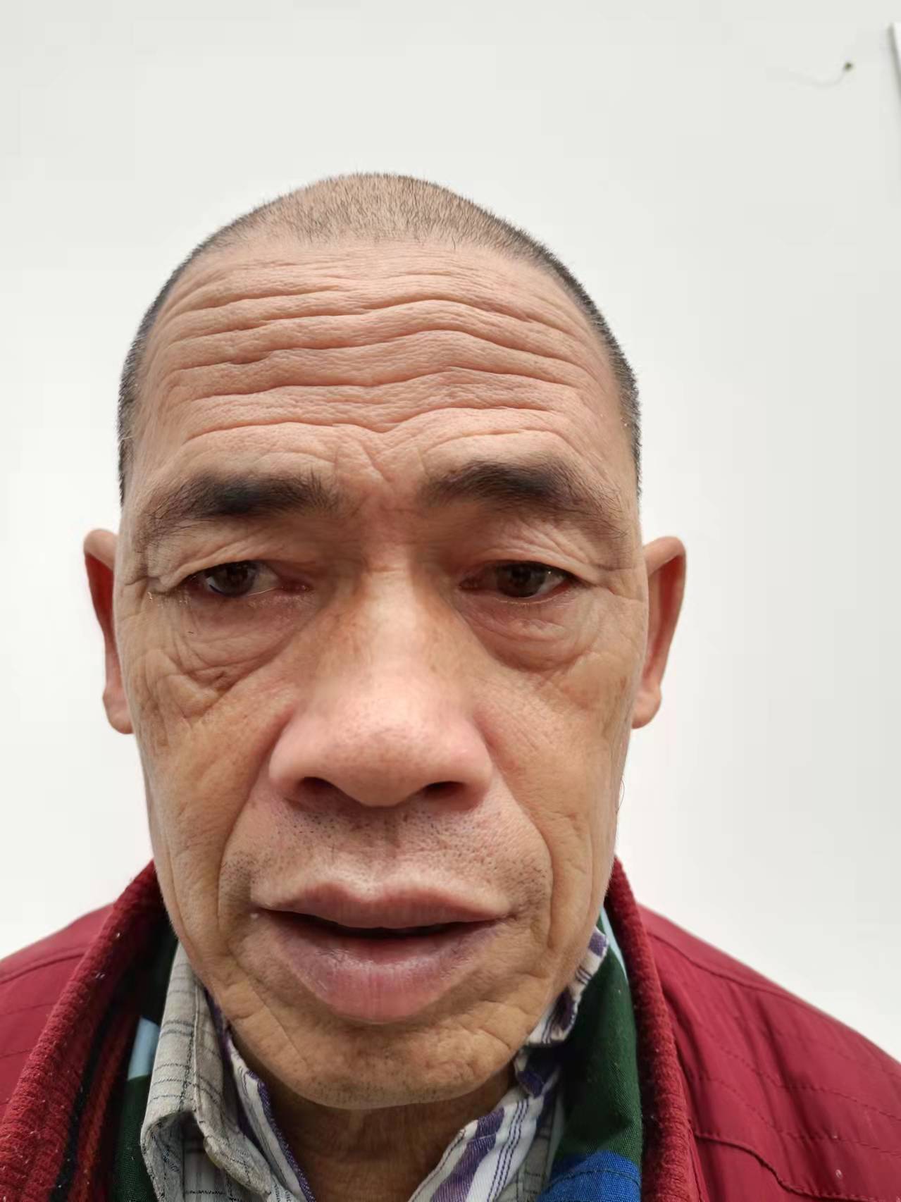 走失者照片 邵阳寻亲：六旬老人被救助，自述叫李...