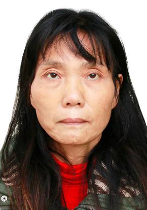 走失者照片 荆州寻亲：五旬女子被救助，穿军绿色...
