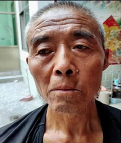 走失者照片 焦作寻亲：六旬老人走失，患小脑萎缩...