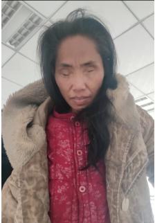 走失者照片 驻马店寻亲：中年女子被救助，视力异...