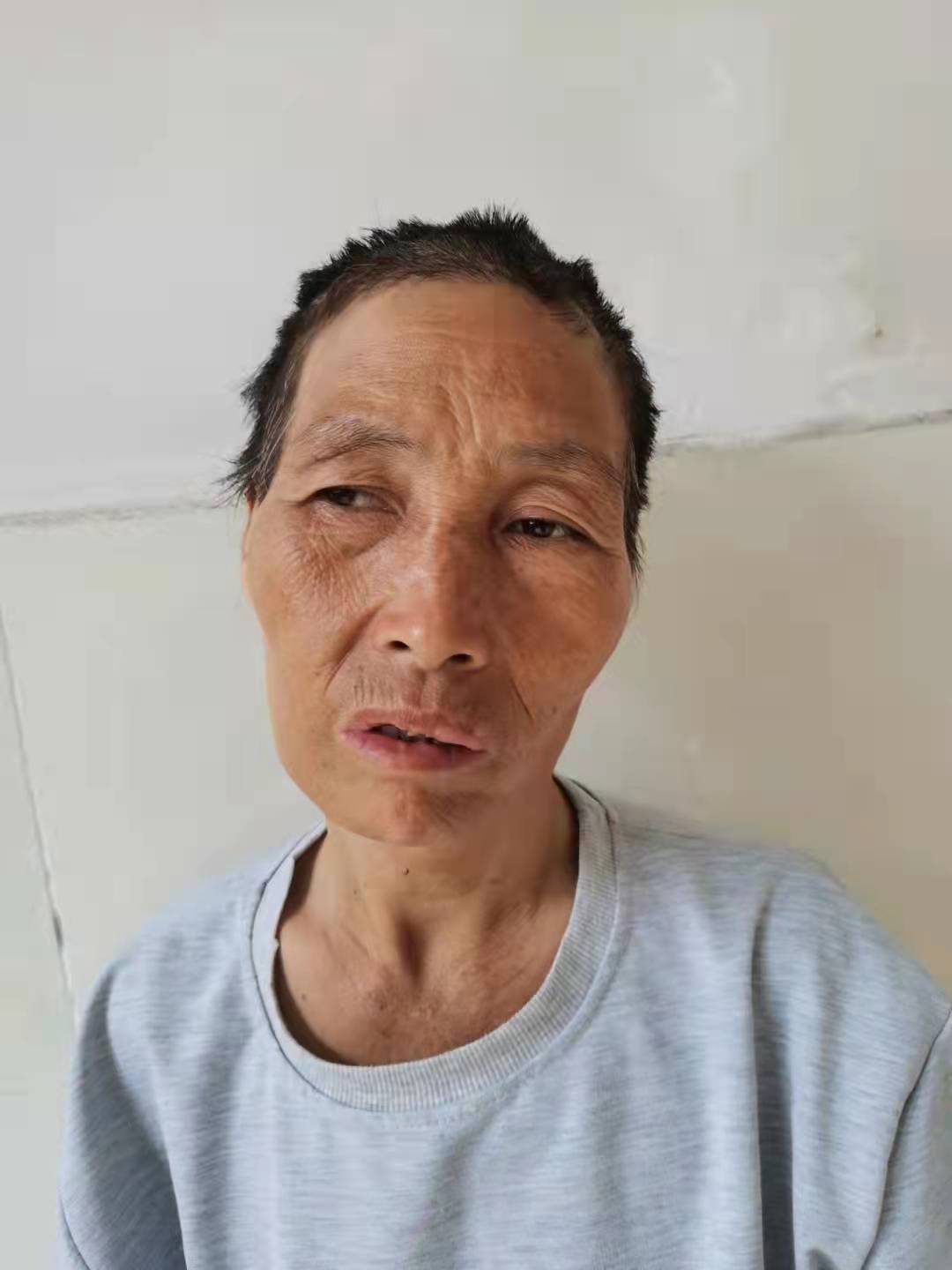 走失者照片 郴州寻亲：五旬女子被救助，穿灰色外...