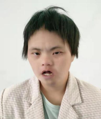 走失者照片 南阳寻亲：青年女子被救助，高1米4...