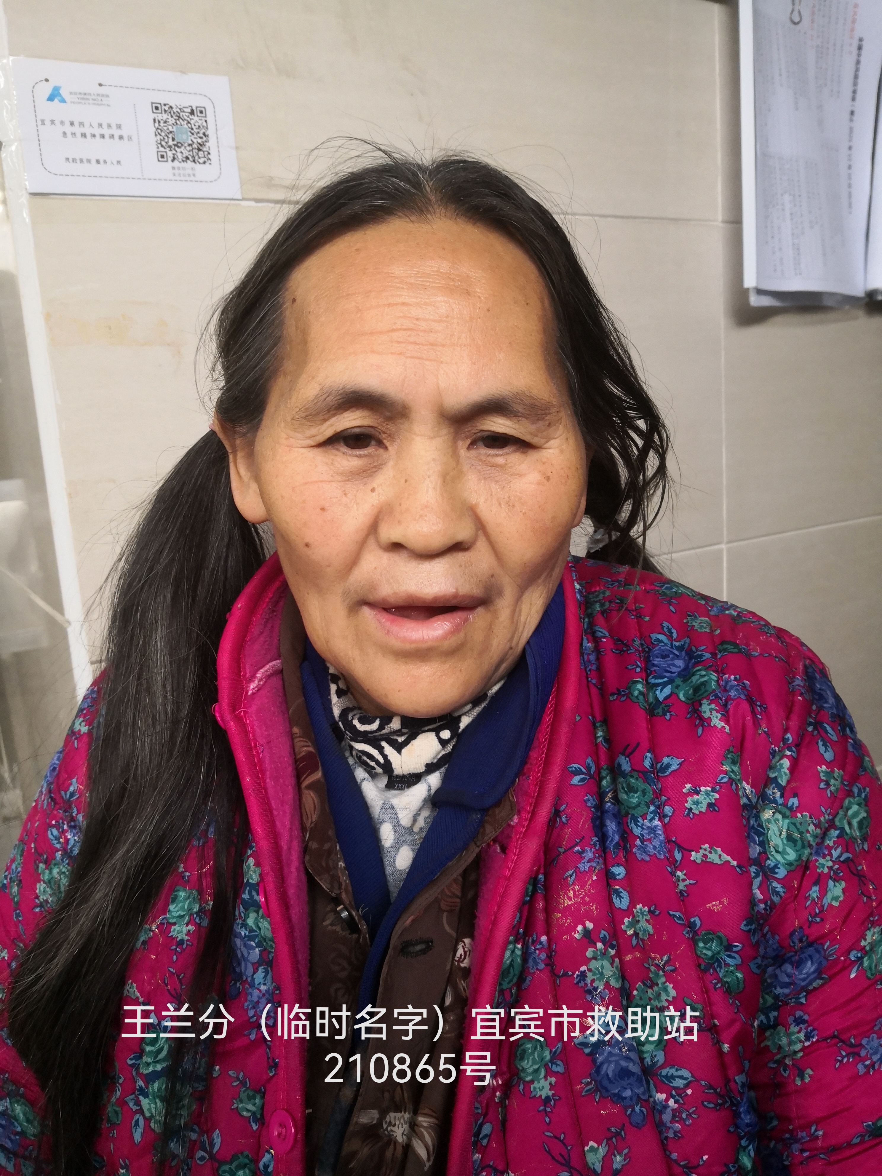 走失者照片 宜宾寻亲：六旬老太被救助，精神异常...