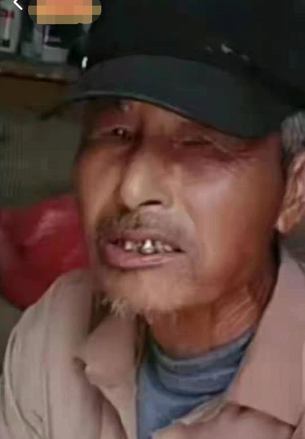 走失者照片 商丘永城急寻：七旬老人走失月余，穿...