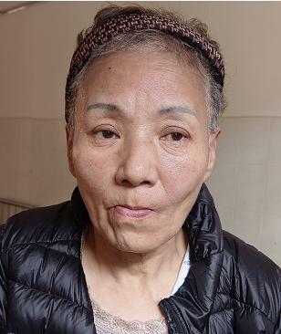 走失者照片 北海寻亲：七旬老太被救助，自述叫毛...