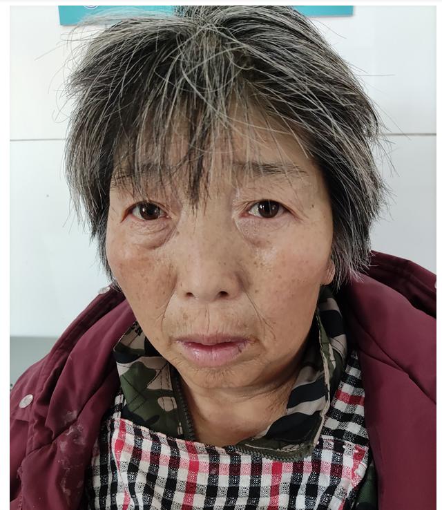 走失者照片 徐州寻亲：六旬老太被救助，自述叫李...