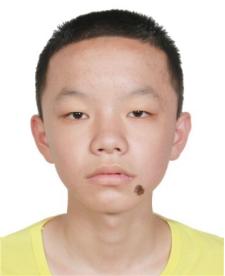 走失者照片 潮州急寻！17岁男孩失联，右嘴角有...